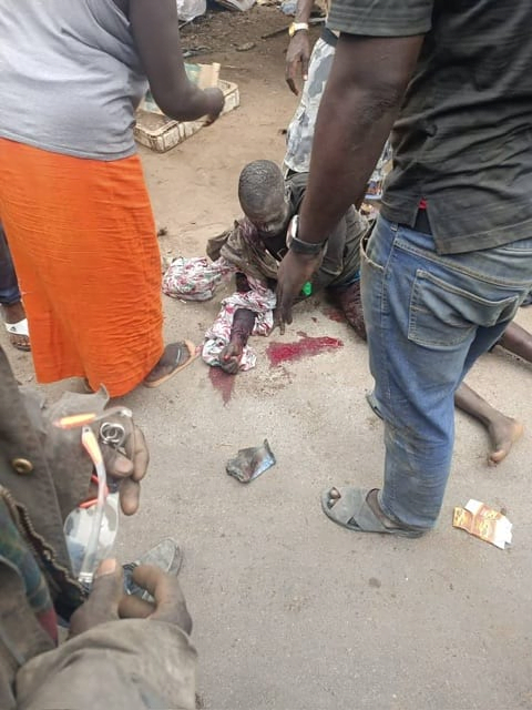 نواذيبو: انفجار قنبلة يخلف ضحايا بينهم 6 جراحهم خطيرة وخسائر مادية