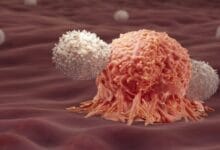 ابتكار جهاز رخيص يكتشف السرطان المبكر بدقة خلال ساعة واحدة